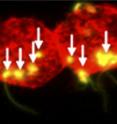 Spermatozoa (arrows) transmit HIV when they attach to dendritic cells (red).