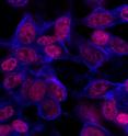 This images shows that after 24 hours cancer cells have taken up chimeric polypeptide
-chemo combination, shown in magenta. This images shows that after 24 hours cancer cells have taken up chimeric polypeptide
-chemo combination, shown in magenta.