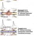 Researchers have shown how an experimental drug might restore the function of nerves damaged in spinal cord injuries by preventing short circuits caused when tiny "potassium channels" in the fibers are exposed by trauma. The compound also might be developed as a treatment for multiple sclerosis. This diagram illustrates how the drug functions as a "channel blocker," meaning it permits the conduction of signals even though the protective myelin insulation has been damaged.