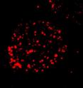 This image shows FCMR expression by immunofluorescence.