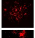 Top: This is beta amyloid plaque as it appears in normally aging Alzheimer's mice. 

Bottom: This is tighter packed plaques in long-lived Alzheimer's mice protect against the disease.