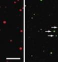 Right: Brain-lipid vesicles. Smaller "dots" indicate smaller vesicles. 
Left: BAR domain protein. The intensity of the dot indicates the amount of BAR bound to the vesicle. The smaller the vesicle, the more curved membrane, and the more binding of BAR.