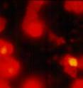 These are chlamydia-filled inclusions (yellow) inside human urethral epithelial cells (red).