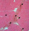 Androgen treatment repaired (arrows) damaged vessels in castrated mice.