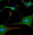 To determine whether specific genes play a role in autophagy in proliferating and quiescent cells, Coller's team reduces the activity of these genes and then determines the amount of autophagy within the cell. To assess autophagy levels in one previous experiment, Sarah Pfau, who earned her bachelor's degree from Princeton in 2008, exposed the cells to a fluorescently labeled antibody that recognizes a protein present on autophagosomes, the structures that cells form to perform autophagy. Areas within the cell where autophagy was taking place glowed green when observed under a fluorescent microscope.