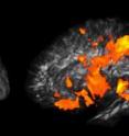 The brain regions important for general intelligence are found in several
specific places (orange regions shown on the brain on the left). Looking
inside the brain reveals the connections between these regions, which are
particularly important to general intelligence. In the image on the right,
the brain has been made partly transparent. The big orange regions in the
right image are connections (like cables) that connect the specific brain
regions in the image on the left.