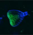 During plant embryogenesis microRNAs, labeled green, play an important part in the tightly orchestrated choreography that determines what goes up and what goes down. They ensure that HD-ZIP III genes are only expressed in the shoot meristem, which gives rise to all the above-ground portions of a plant.