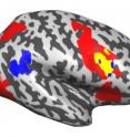 Brain regions that are active when an individual was actively searching for a target letter are shown in red; those that reacted to a surprise stimulus are shown in blue. The inferior frontal junction, shown in yellow, was involved in both processes and is believed to play a primary role in coordinating the two different types of attention.