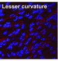 These images show reduced levels of HuR (red) in the thoracic aorta and an area with greater curvature, compared to a region with less curvature, which is prone to atherosclerosis because endothelial cells (blue) are exposed to disturbed flow there.