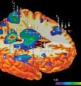 Studies show that certain brain structures are smaller or larger than normal in alcohol-exposed children, while brain regions in meth-exposed children were similarly affected, if not more so. Shown in color are brain areas that differed among alcohol-exposed, meth-exposed and unexposed children -- notably the caudate nucleus (left) and the cingulate cortex (right). Superimposed graphs show group differences.