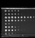 The plating experiment in this image shows how yeast strains vary in resistance to a drug. Different strains (horizontal rows) were grown at cell densities that decrease from left to right. Sensitive strains only are capable of growing when plated at high density, while resistant strains are capable of growing even at low density. By studying very large populations of yeast, Princeton scientists have developed a new way to identify the hidden genetic material responsible for genetically complex drug resistance traits.