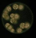 The image shows a vegetative female colony. <I>Volvox carteri</I> forms spherical colonies, which are composed of 2,000 to 4,000 individual cells embedded in an extracellular matrix. During non-sexual reproduction, so-called gonidia in both male and female (pictured) colonies produce juvenile colonies through repeated division.