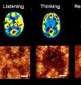 Magnetic resonance images of human brain during different functions appear on top. Similar evolving patterns have been generated on the molecular monolayer one after another (bottom). A snapshot of the evolving pattern for a particular brain function is captured using Scanning Tunneling Microscope at 0.68 V tip bias (scale bar is 6 nm). The input pattern to mimic particular brain function is distinct, and the dynamics of pattern evolution is also typical for a particular brain operation. Magnetic resonance images of human brain during different functions appear on top. Similar evolving patterns have been generated on the molecular monolayer one after another (bottom). A snapshot of the evolving pattern for a particular brain function is captured using Scanning Tunneling Microscope at 0.68 V tip bias (scale bar is 6 nm). The input pattern to mimic particular brain function is distinct, and the dynamics of pattern evolution is also typical for a particular brain operation.