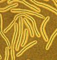 Overexpression of CapD results in a smaller capsule in <i>Bacillus anthracis</i>. Capsule is indicated as the clear area around the bacillus. Wild-type strain is shown on the left and the strain over-expressing CapD is shown on the right.