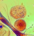 An ARMAN cell (center, orange) is penetrated by a needle-like protrusion from Thermoplasma (lower left), an <i>Archaea</i> that lives in the same acidic pools as ARMAN. The much smaller, yellow lozenges are viruses that also infect ARMAN cells. A probably dying ARMAN cell (top) has grown to a diameter of about 1,000 nanometers -- less than one hundredth the width of a human hair.