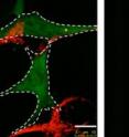 Parkin (green) promotes the turnover of damaged mitochondria (red, left), but defective organelles accumulate near the nucleus if Parkin lacks its ubiquitin ligase activity (right).