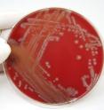 Disease-causing microbes such as <E. coli</i>, shown growing in a lab dish, may one day be silenced using a new plastic-like material that blocks the chemical signals bacteria use to communicate.