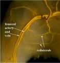 This is a photo of inner thigh circulation of a newborn mouse, showing several collaterals interconnecting the main artery supplying the leg with arteries located in the thigh.