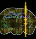 This is an artistic rendition of an ultrasound pulse being transmitted into intact brain circuits.