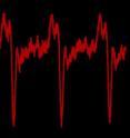 Colorized trace of pulses from the NIST/JILA "dark pulse" laser, indicating the light output nearly shuts down about every 2.5 nanoseconds. Colorized trace of pulses from the NIST/JILA "dark pulse" laser, indicating the light output nearly shuts down about every 2.5 nanoseconds.