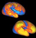 Areas of expansion in the human cortex during infancy and childhood, top, closely match areas of change in the human brain when compared to the brains of apes and monkeys. Yellow areas expanded the most, followed by orange, red, blue and light blue areas.