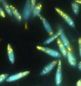 Scientists at Washington University School of Medicine in St. Louis recently showed that when a key protein was genetically disabled, the parasite <i>Leishmania</i> couldn't start infections in cell cultures and animals. Parasites in this picture have been stained so that compounds known as polyphosphates appear yellow. The structures where the parasite normally stores these compounds are misshapen and empty in mutant parasites that lack the TOR kinase 3 protein.