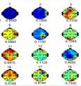 Some examples of the brain topology detection scan.