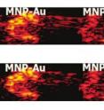 On top are photoacoustic images taken for gold nanorods (left), the new UW particle that has a magnetic core and surrounding gold shell (center), and a simple magnetic nanoparticle (right). Below is the same image after processing to remove pixels not vibrating with the magnetic field. The center blob is retained because of the particles' magnetic core and is bright because of the particles' gold shell.