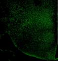 A green stain lights up a protein tied to aging, showing that it is abundant in the hypothalamus region of mice brains.