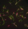 This is an image of <I>Salmonella</I> bacteria taken in Dr. Ferric Fang's lab at the University of Washington. The  bacteria are stained with reagents to show the flagella (green), DNA (blue) and cell membrane (red).