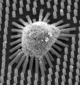 This is an image taken with a scanning electron microscope of a human mesenchymal stem cell growing on a plate of long microposts approximately 13 microns in length. After one day of culturing, this cell exerts centripetal force, which can be seen in the bending of the microposts. This cell will differentiate into a fat cell.
