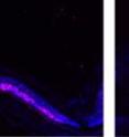 The image on left shows damage (pink) to the retina. The image on right shows that POD GDNF nanoparticles protected the retina from damage.