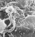 This is a scanning electron micrograph of HIV-1 budding from cultured lymphocyte.