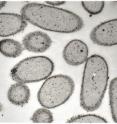 Bacterial cells that can accumulate high quantities of precious metals are an efficient and green alternative to traditional recycling methods. Here, <I>E. coli</i> cells are surrounded by nanoparticles of palladium and gold (black deposits).