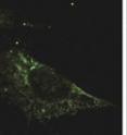 Sites of autophagy (green) are reduced in cells lacking HMGB1 (left) compared with control cells (right).