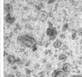 Electron microscopy of purified cell culture supernatants reveals that cells overexpressing CD9 (middle) or CD82 (right) produce more exosomes than control cells (left). Exosomal release of beta-catenin and inhibition of Wnt signaling may explain why CD82 and CD9 suppress tumor metastasis.