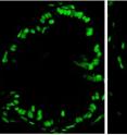 Sections of zebrafish intestines show more proliferating cells (in green) in fish reared in the presence of microbes, left, versus those reared under sterile conditions at right.