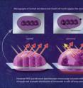 Nano-scale disturbances in cheek cells indicate the presence of lung cancer. Regular microscopy looking at chromatin, the genetic material inside a cell's nucleus, will not reveal significant dissimilarities between the cheek cells of a healthy person and those of a lung cancer patient. However, a new technique called partial wave spectroscopic microscopy zeroes in on smaller-than-microscopic disturbances at the nano-level, which are harbingers of trouble.