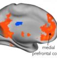 Brain regions that respond to information about friends are shown in orange and overlap a network of regions known to process personally relevant stimuli; regions that respond more to strangers are in blue. Notably, whether the person was perceived to be similar to the participant made no difference in brain response, suggesting that social alliances outweigh common interests.