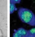 B-CARS chemical imaging: Test cells from a mouse as seen in an optical microscope image (l.), and using B-CARS (r.). The CARS image detects specific molecules to highlight the cell nucleus (green) and intracellular fluid (blue). Images show an area approximately 40 micrometers across. B-CARS image represents approx. 17,000 individual spectra.