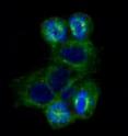 This is a fluorescence microscopy image of abnormal mitotic spindles in four breast cancer cells that were treated with antibody-linked maytansine. The chromosomes (blue) are not able to arrange in normal symmetrical functional spindles because the dynamics of the microtubules (green) are inhibited by the drug. The drug-treated cells cannot divide and ultimately die.