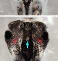 An electrical switch for melanoma: biologists at Tufts University have discovered that a change in membrane voltage in newly identified "instructor cells" can cause stem cells' descendants to trigger melanoma-like growth in pigment cells (melanocytes). Hyperpigmentation can be seen in the treated tadpole embryo (B, red arrows), but not in the control embryo (A). The pigment cells not only grew in greater numbers but also formed long, branch-like shapes and invaded neural tissues, blood vessels and gut in a pattern typical of metastasis. Discovery of this novel bioelectric signal and cell type could aid in the prevention and treatment of diseases like cancer and vitiligo as well as birth defects. Tufts biologists manipulated the electrical properties of a special, sparse cell population present throughout the embryo by using the common anti-parasitic drug ivermectin to open the glycine gated chloride channel (GlyCl). The GlyCl channel is one of the many ion channels that control cellular membrane voltage and is a marker of this unique "instructor cell" population. Changing the chloride ion level to hyperpolarize or depolarize the cells in turn triggered abnormal growth in distant pigment cells derived from the neural crest stem cells.