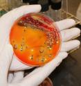 Salmonella is the most common cause of food poisoning in the United States, according to the Centers for Disease Control. <I>Salmonellosis</I>, the disease caused by salmonella, causes diarrhea, vomiting, fever, abdominal cramps and, in severe cases, death.