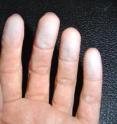 This is a photo of researcher Laurel Sharmer's fingers after handling an antique white painted window frame that sold for $85. The window had almost 5,000 parts per million of lead.