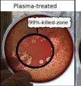 Bacterium killing with plasma: The blood-agar dishes seeded with haemolytic <i>Staphylococcus aureus</i> are shown, plasma treated (left) and untreated control (right).