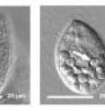 The quantum dot-tainted bacteria stop digestion in the protozoan, and food vacuoles with undigested material accumulate, seen in the right image. This is in contrast to the normal condition of protozoa eating untreated bacteria, seen in the left image.