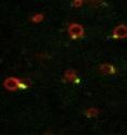 Endosomes in live cells with b2AR tubules emanate from the specialized domains marked by actin.