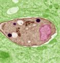 <I>Toxoplasma gondii</I> and other related parasites surround themselves with a membrane to protect against factors in host cells that would otherwise kill them. Scientists at Washington University School of Medicine in St. Louis have identified a parasite protein that protects this membrane from host proteins that can rupture it. Accoding to the researchers, disabling the parasite's defensive protein could help give hosts an advantage in the battle against infection.