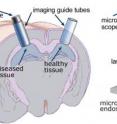 This is a diagram of the experimental setup. (left) Tiny optical instruments called microendoscopes are inserted into glass imaging guide tubes, which maintain a precise position in the brain. This allows researchers to view the exact same neuron with a microscope (right) again and again, a new technique for brain researchers. Scientists can also compare diseased tissue, such as a tumor, to healthy tissue in the same animal.