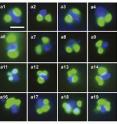 A collection of rappemonad cells photographed by a high-powered microscope. Each cell contains at least two chloroplasts (green dots) and a nucleus (blue dots). A collection of rappemonad cells photographed by a high-powered microscope. Each cell contains at least two chloroplasts (green dots) and a nucleus (blue dots).